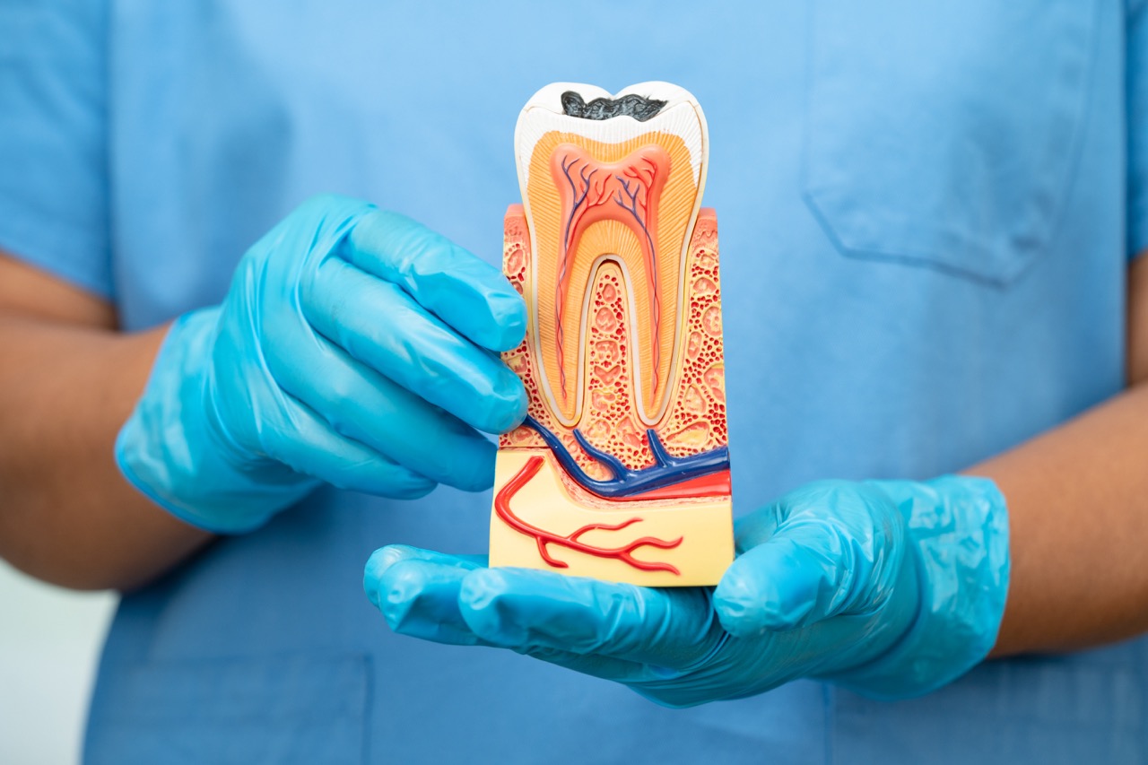 Asian dentist holding dental implant, artificial tooth roots into jaw, root canal of dental treatment, gum disease, teeth model for dentist.